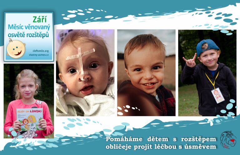 Rozštěpy obličeje a pomoc, kterou už 20 let přináší organizace Šťastný úsměv